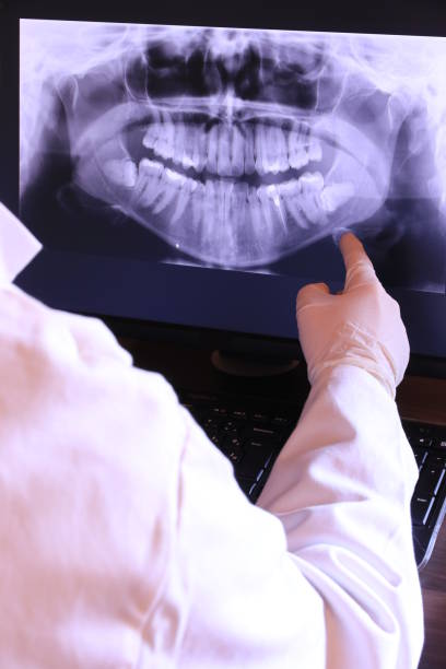 Best Emergency Wisdom Teeth Removal in Ransom Canyon, TX