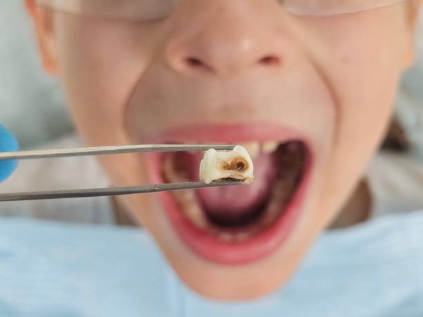 Best Emergency Dental Surgery in Ransom Canyon, TX